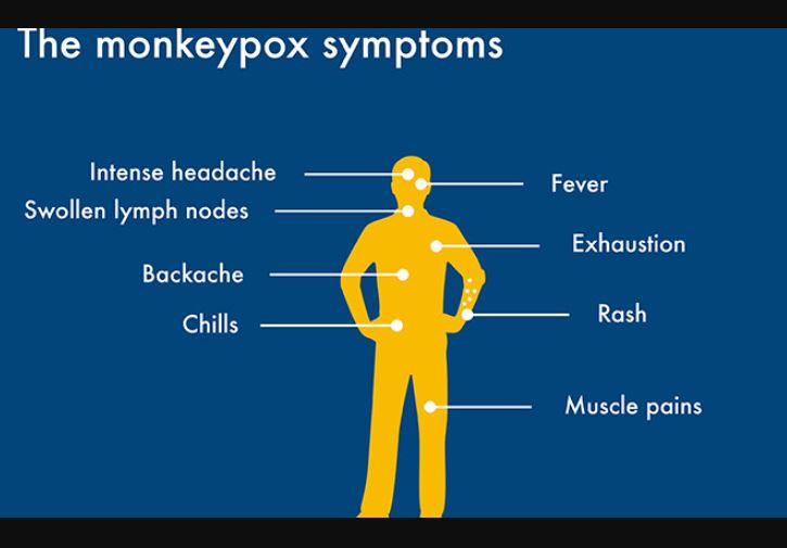 যেসব লক্ষণ দেখে বুঝবেন আপনি মাঙ্কিপক্সে আক্রান্ত